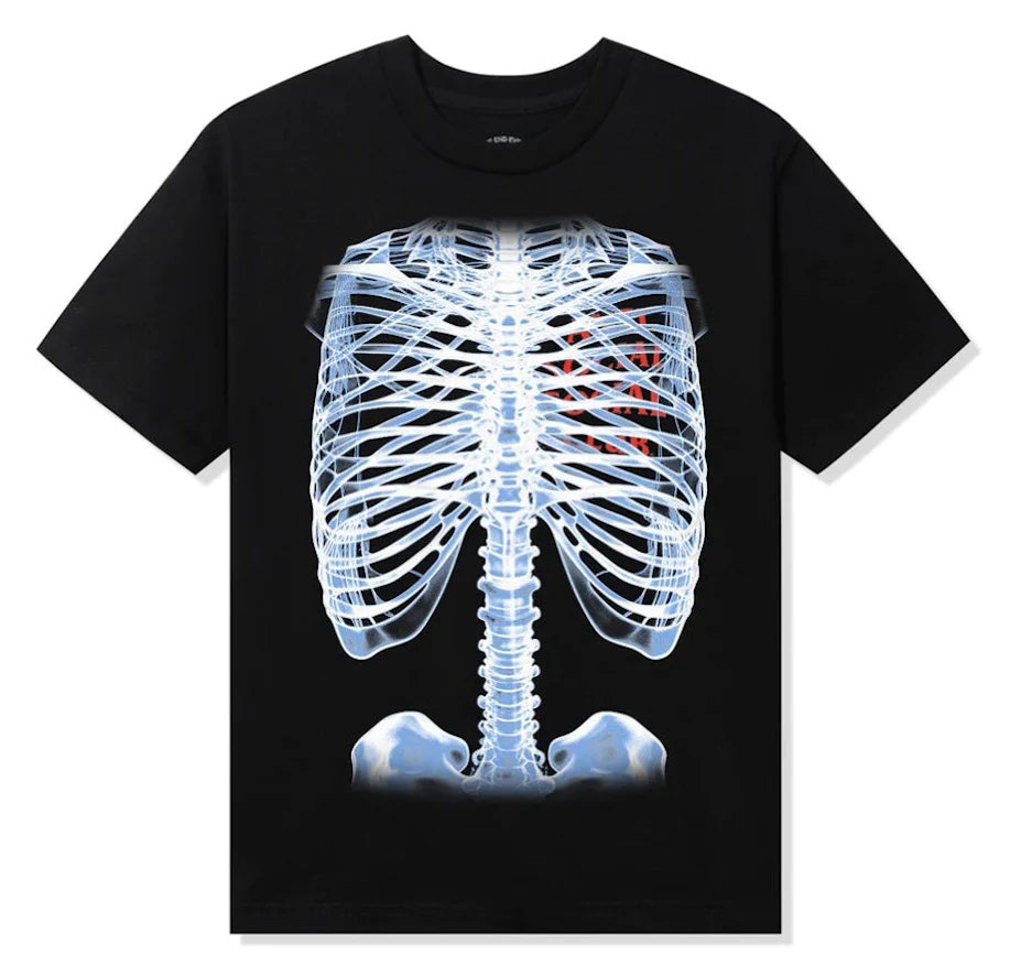 PLAYERA ANTI SOCIAL SOCIAL CLUB BONES (NEGRO)