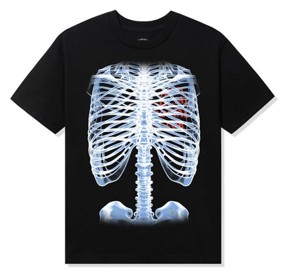 PLAYERA ANTI SOCIAL SOCIAL CLUB BONES (NEGRO)